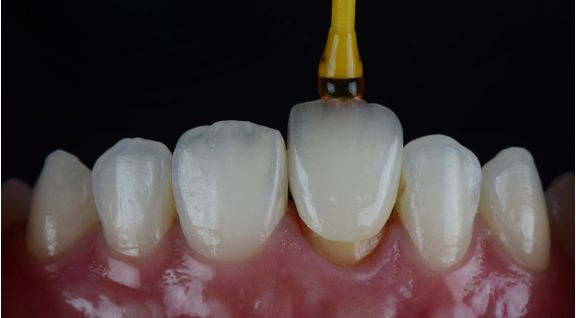 POSGTP004P15102.jpg
