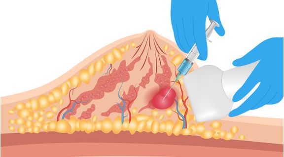 CUATTP002P15147.jpg
